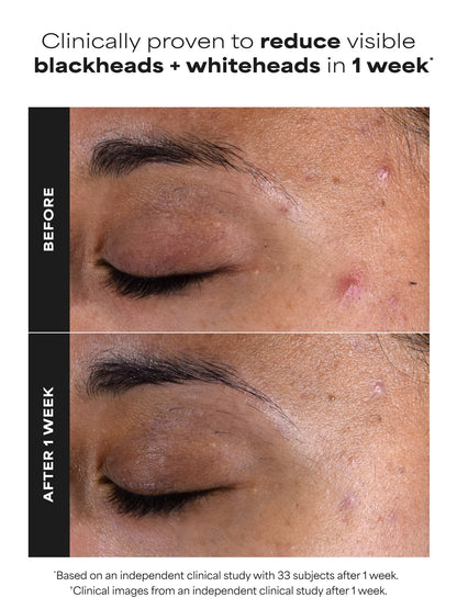 2% BHA Liquid Exfoliant